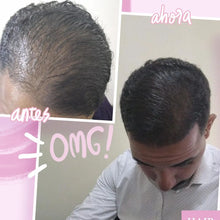 Load image into Gallery viewer, Kit para Hombres / Man's Hair Loss Control Bundle