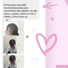 Load image into Gallery viewer, Kit para Hombres / Man's Hair Loss Control Bundle