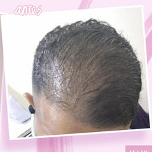 Load image into Gallery viewer, Kit para Hombres / Man's Hair Loss Control Bundle