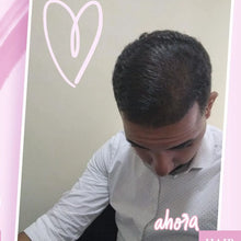 Load image into Gallery viewer, Kit para Hombres / Man's Hair Loss Control Bundle