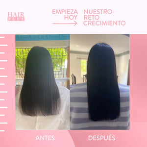 Kit de Crecimiento / Hair Crecimiento  Bundle