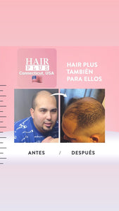 Kit para Hombres / Man's Hair Loss Control Bundle